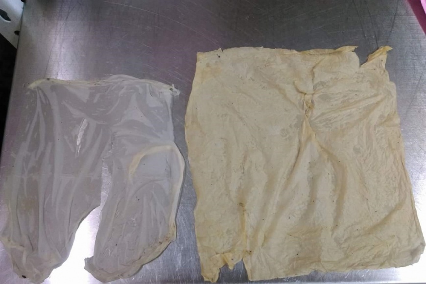 逆轉?當歸鴨老闆控「加料栽贓」 客人現身打臉