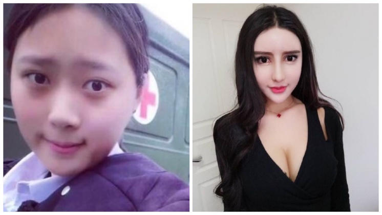 FotoJet (16) - FotoJet (16).jpg 曹瑋自認整形成「高級臉」後變成人生勝利組,圖/翻攝微博