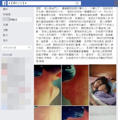 男童被老師打到血尿嘔吐 幼兒園拿3600元紅包想打發 翻攝自爆料公社 (2) - 男童被老師打到血尿嘔吐 幼兒園拿3600元紅包想打發 翻攝自爆料公社 (2).jpg 圖/翻攝自《爆料公社》