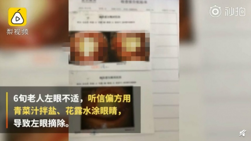 陸婦花露水洗眼睛1 - 陸婦花露水洗眼睛1.jpg 圖/翻攝自秒拍