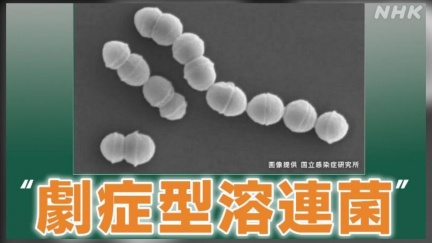 食人菌全日本染疫數破1100人　5孕婦這時間點感染亡