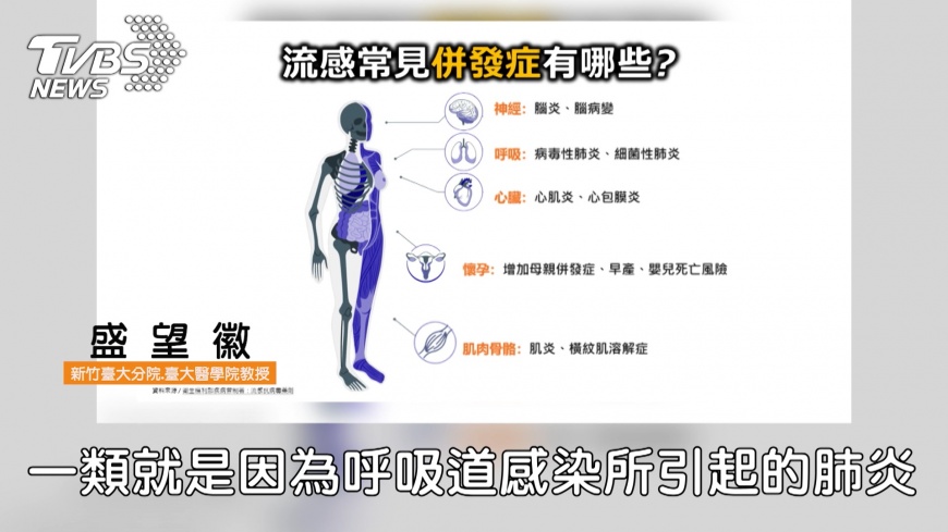 夏季流感來襲，流感全年化趨勢再升溫！併發重症高危險群應多留意