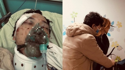 《豆腐媽媽》替身重傷出院　「4後遺症」纏身