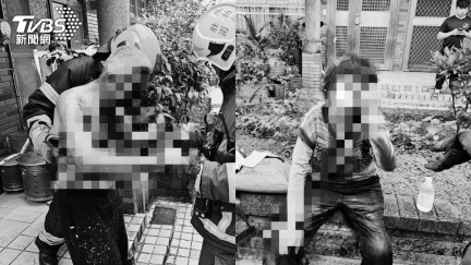 可疑包裹拆開竟爆炸！宜蘭姊弟「渾身是血」　警方出手了