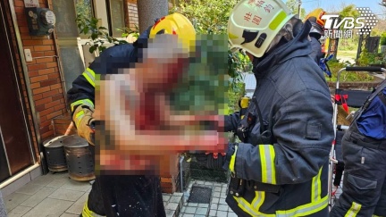 宜蘭包裹爆炸！爆「歹徒上門」送火藥　2姊弟全身血