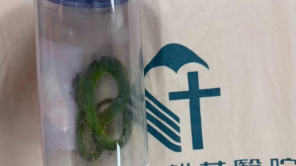 老翁遭蛇咬傷用口吸！還把蛇打死帶去醫院　醫揭錯誤自救法