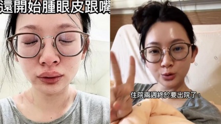 優格姐姐「蕁麻疹爆發瀕死」送醫搶命　現況曝光