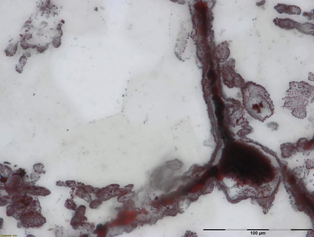 赤鐵礦的絲狀體附著在右下方的鐵礦，這些鐵質絲狀和團塊是微生物的細胞，類似於海底熱泉噴口發現的現代微生物。（取自flickr網頁UCL News）