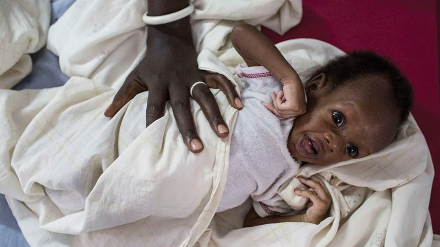 南蘇丹目前陷入飢荒，孩童嚴重營養不良。（東方IC）