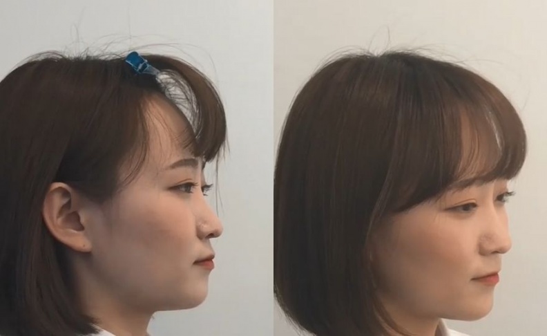 詳解！韓國髮型師「一支髮夾」解決髮流不順、頭型扁塌4症頭