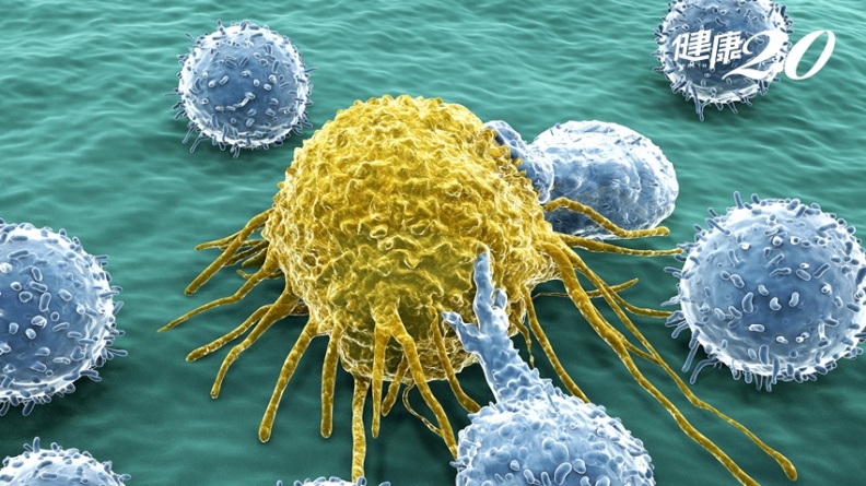 摧毀癌細胞！「醣脂GD2」癌症標靶，強化免疫治療效果