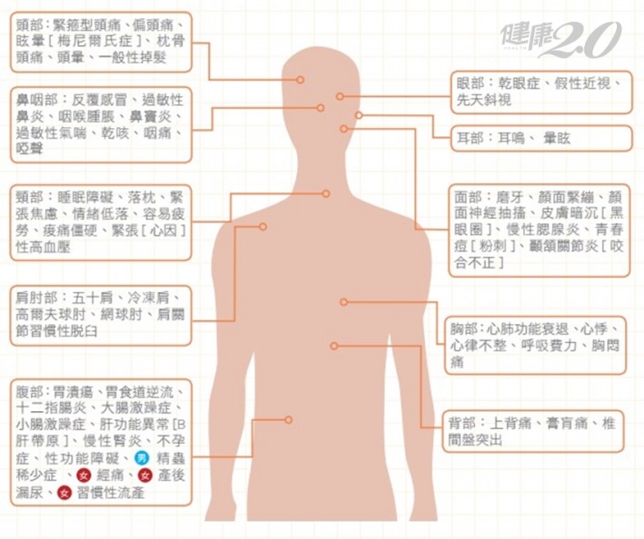 慢性病 疼痛 關節退化可能都是 筋膜沾黏 健康2 0