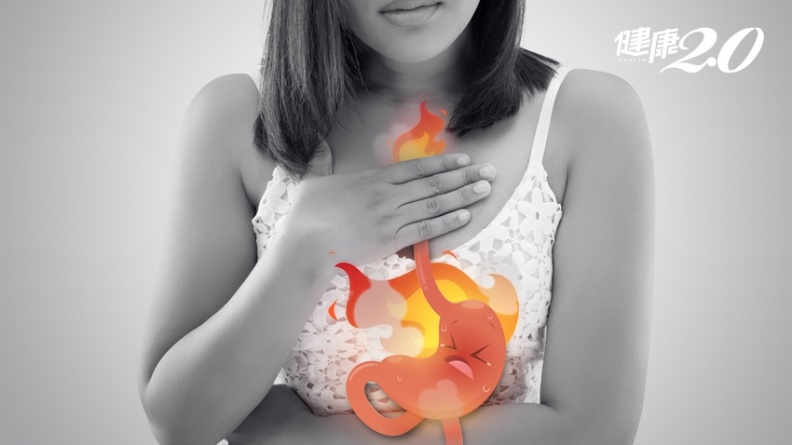 火燒心、吞嚥困難、口腔酸酸 一定是得到胃食道逆流？