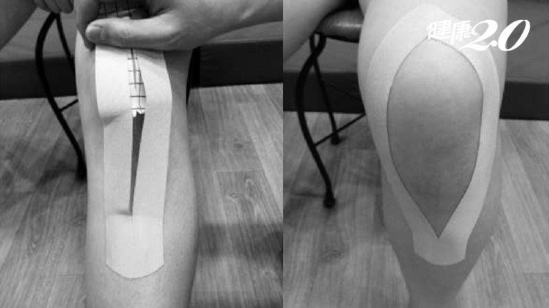 1招強化膝蓋力！正確「貼紮」矯正姿勢 有效改善膝蓋疼痛