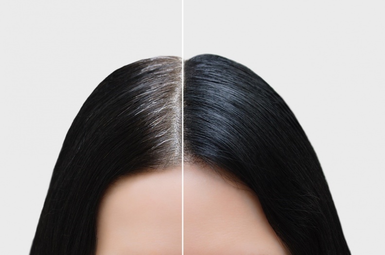 頭皮也有初老症頭？MIT髮肌專家重磅推出胜肽級「喚黑小紫瓶」，頭皮養護有得解！