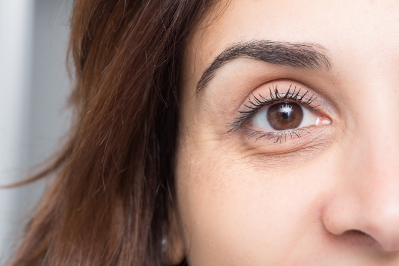 黑眼圈可以這樣救！皮膚科醫師解釋形成原因有三種，加碼阿Sa遮黑眼圈４步驟，眼睛超有神