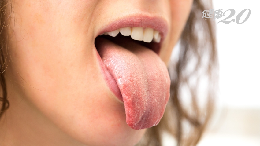 舌頭有紅點、黃色舌苔…中醫師教你吃「舒心飲食」