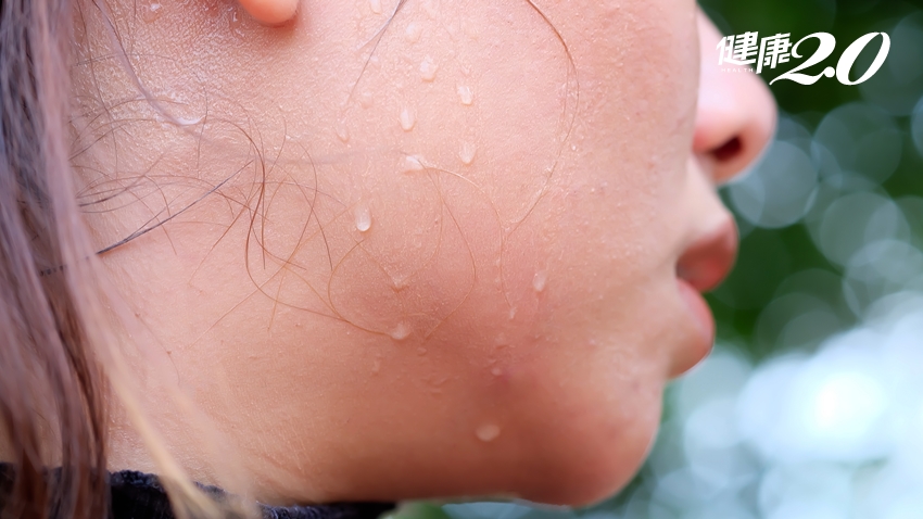 圖解！3種皮膚病是「流汗」害的，原因症狀療法一次告訴你