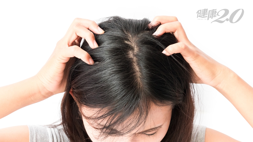 頭皮紅腫刺痛 對頭皮好 的３個要點 健髮又紓壓 健康2 0