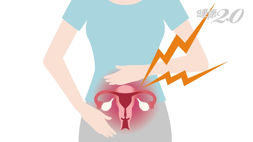 女性注意！小心「吃」出子宮肌瘤 這５種食物是子宮殺手