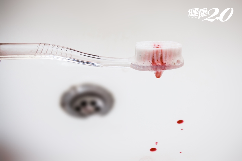 牙齦流血是健康亮紅燈！置之不理…慢性發炎「延燒」全身