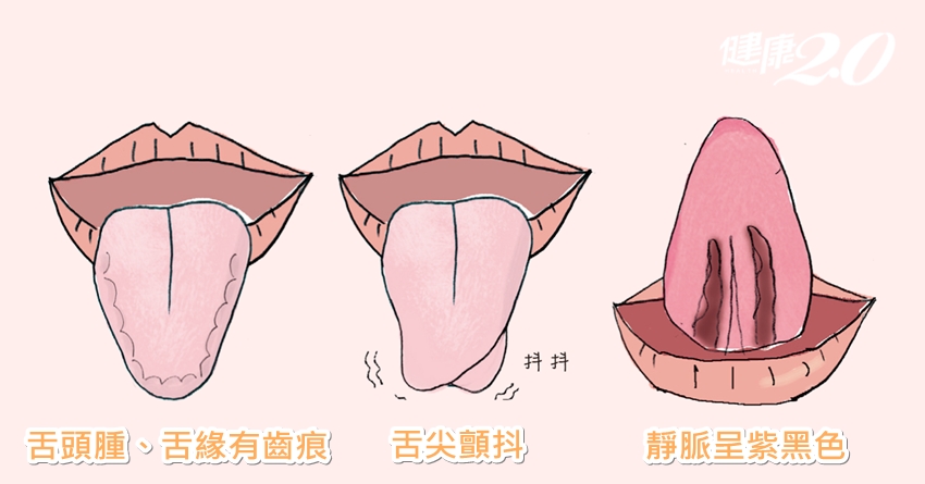 伸出舌頭看一看 15個身體大小毛病通通現形！
