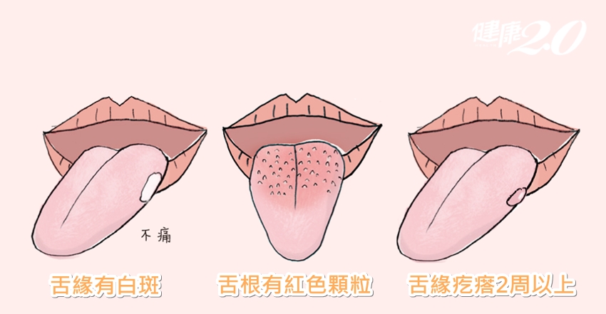 伸出舌頭看一看 15個身體大小毛病通通現形！