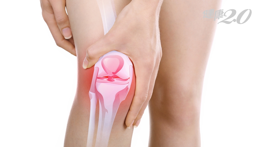 95％膝關節炎都是「菜瓜布」害的？關節權威教你「逆轉關節痛」
