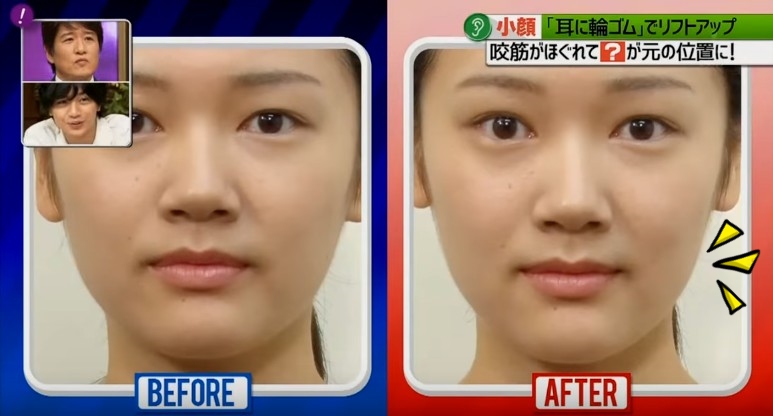 好神奇！日本「一根橡皮筋」瘦臉法，3穴位讓臉又V又小
