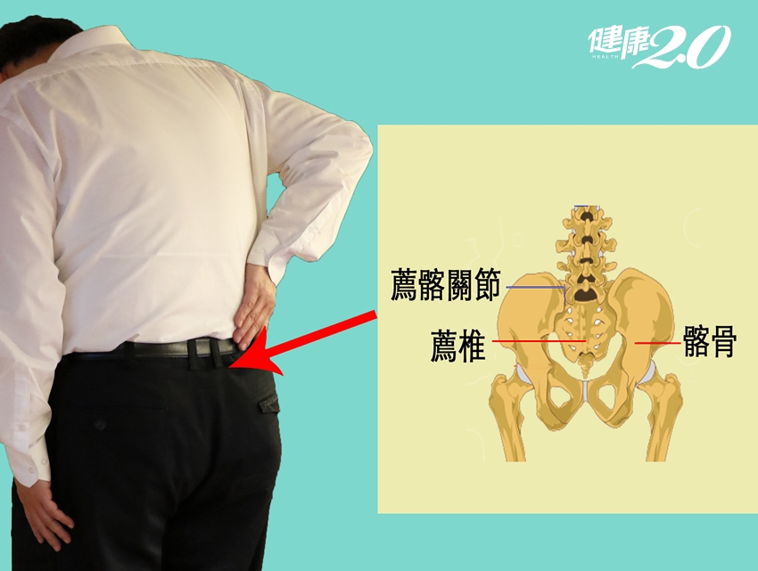 15％下背痛找不出原因…痛處在「褲腰帶以下」恐是薦髂關節病變