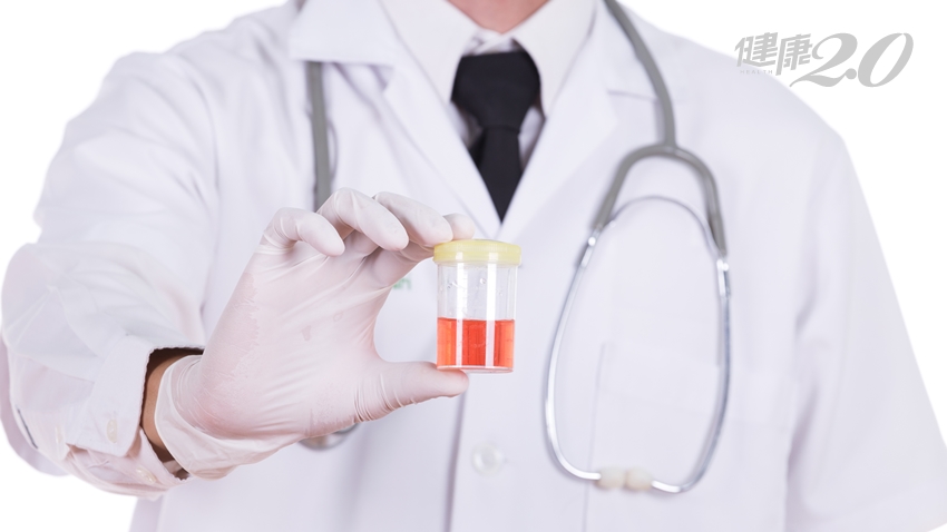 發現血尿怎麼辦？醫師釐清4原因，尤其「不會痛的」才危險