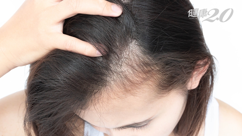 女性掉髮原因多 體質濕熱、氣血虛、壓力大…你是哪一種？