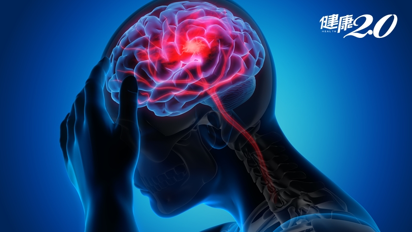 頭痛會不會是長腦瘤？腦瘤６大警訊 提早發現是關鍵