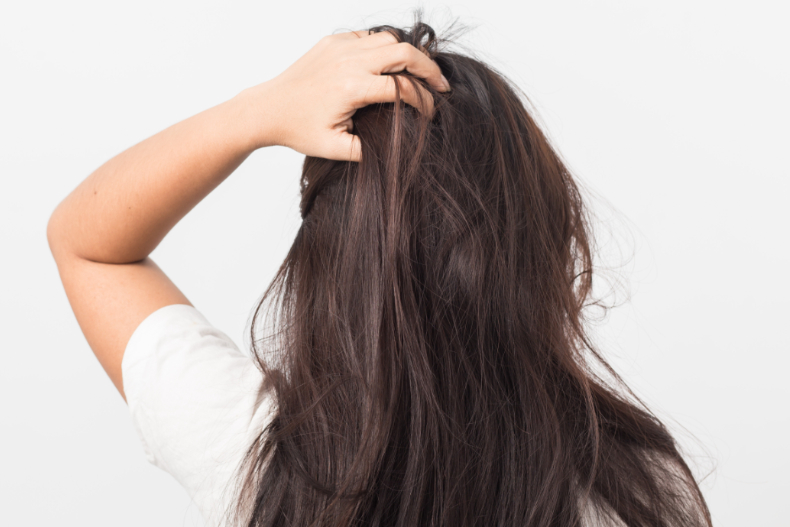 「戒斷洗髮精」不油不臭還可減少落髮？誤信傳言，恐頭癬、油頭纏身一輩子