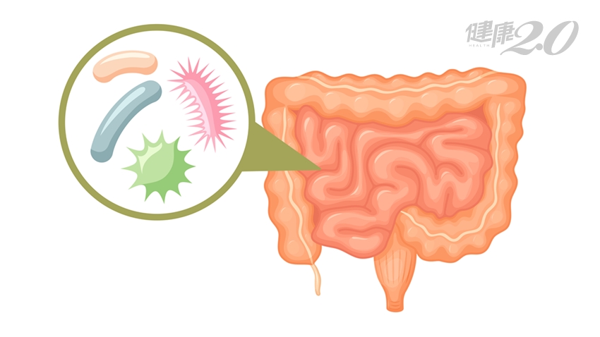 餵飽體內「微生物」，免疫系統更堅強！微生物最愛６種發酵食物