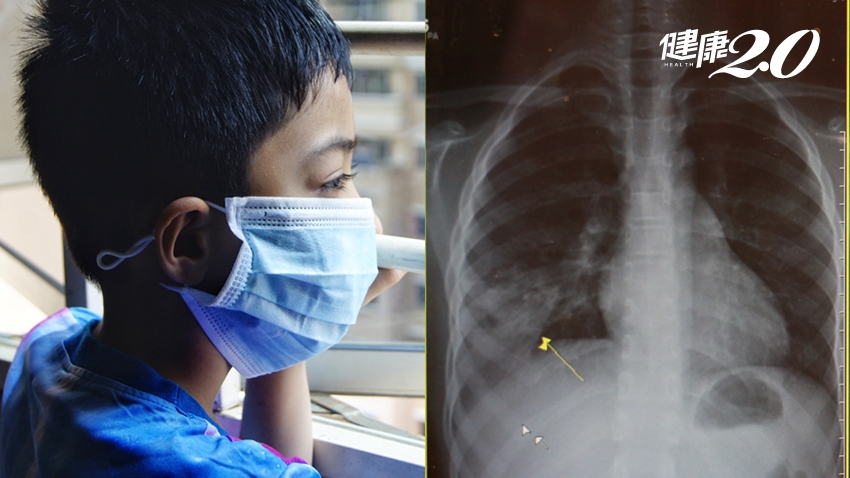 10歲男童輕微肺浸潤、疑似肺炎…爸爸在陽台做這件事害的！
