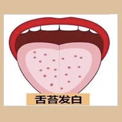 健康的舌苔長這樣！從5種「舌苔顏色」看懂身體警訊，發黃＝消化出問題