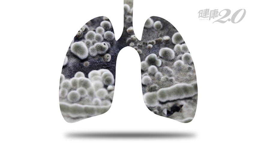每54分鐘就有1人死於肺癌！高齡得肺癌該放棄治療嗎？