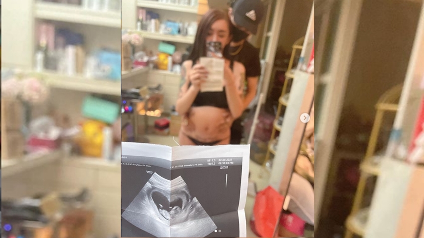 28歲變性網紅「罔腰」宣稱懷孕 高醫回應：子宮移植人體試驗還在申請中