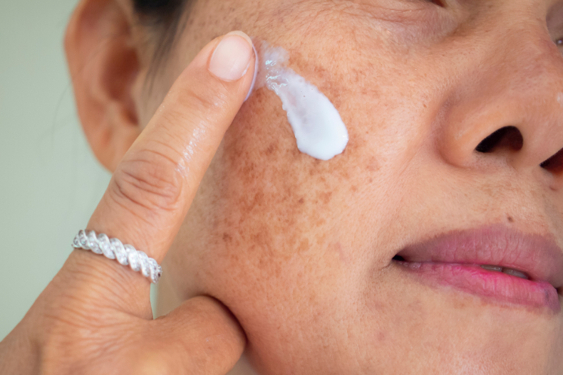 臉上斑點長不停？皮膚專家親曝「斑點類型、預防方法」：錯誤保養只會讓斑點更惡化