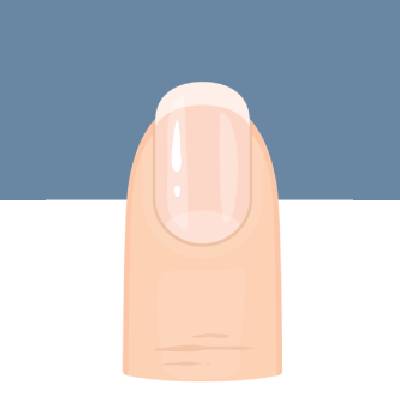 指甲出現黑直紋，小心是皮膚癌？從6種「指甲狀態」看懂身體健康