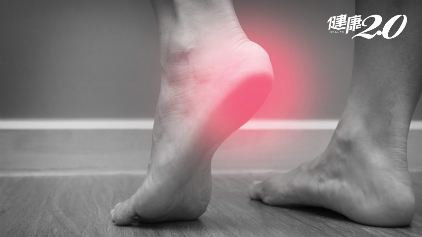 腳跟痛不一定是足底筋膜炎！醫師告訴你怎麼回事，4點防腳跟痛