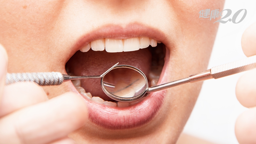 口腔是身體健康的照妖鏡！４個重點判斷牙周有沒有問題？快學起來