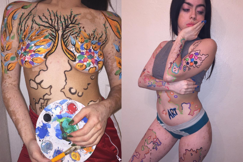 美，不只一種！白斑症女孩把「身體當畫布」：我覺得自己是藝術，並為此感到高興