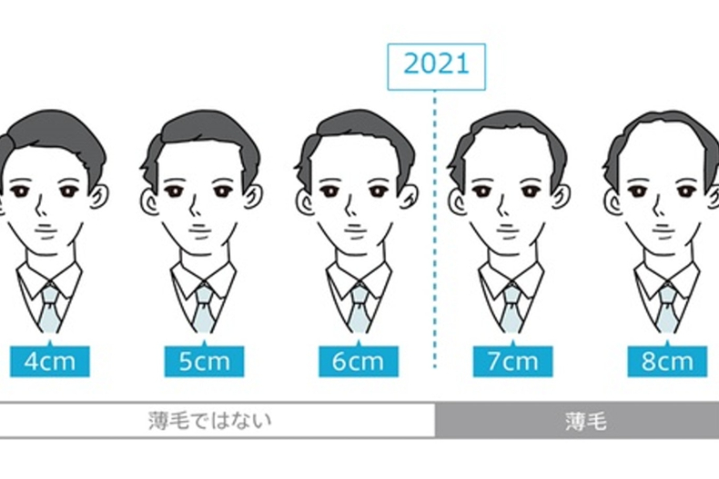 日本最新「禿頭標準」出爐！眉上至額頭「X公分」面臨「髮量危機」，網哀：太嚴格