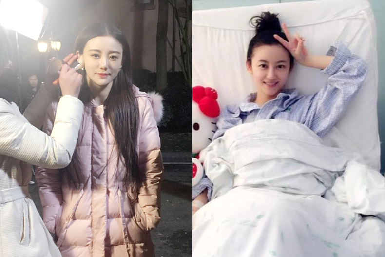 誤信拔罐放血抗癌！「小趙雅芝」淪搖錢樹養一家八口：累到罹癌、皮膚潰爛，25歲不幸病逝