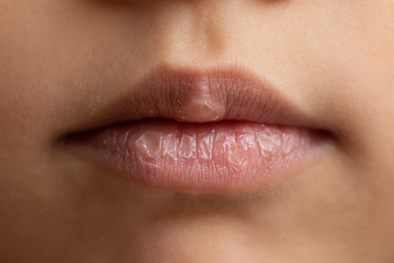 ５種唇色看身體健康！醫揭：嘴巴出現「這顏色」，恐是心臟衰竭徵兆