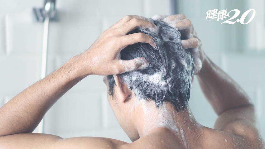 頭皮屑超多，常洗也一樣？醫曝6件事恐致「脂漏性皮膚炎」，洗髮精要這樣選
