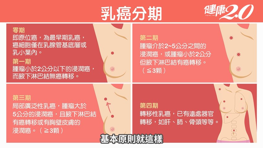 名醫江坤俊揭露：乳癌「最好發位置」！直言「這年紀」根本毀滅性打擊