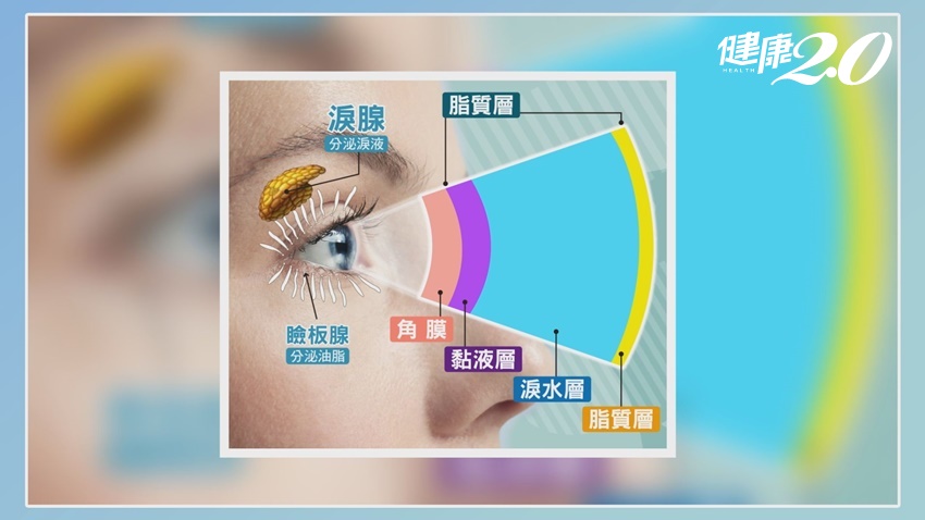 流目油是乾眼症？醫說「多眨眼」是拯救眼乾最佳法寶 保養4招眼睛不痠澀